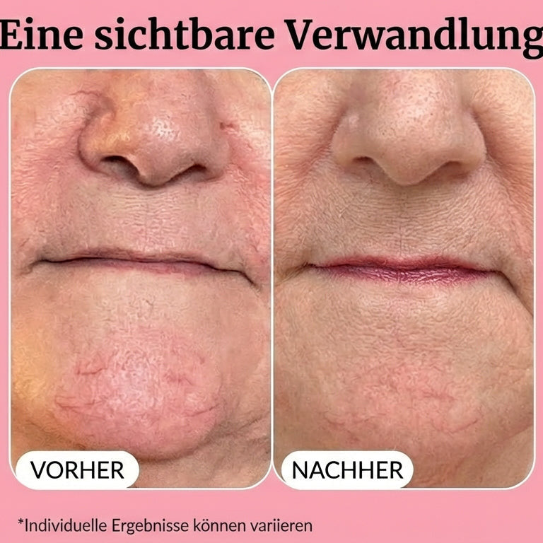 Norea Beauty - Vitamin C Super Serum